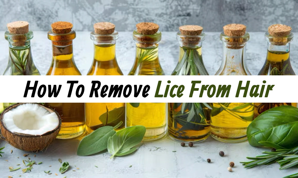 Effective Home Remedies To Get Rid Of Lice Naturally